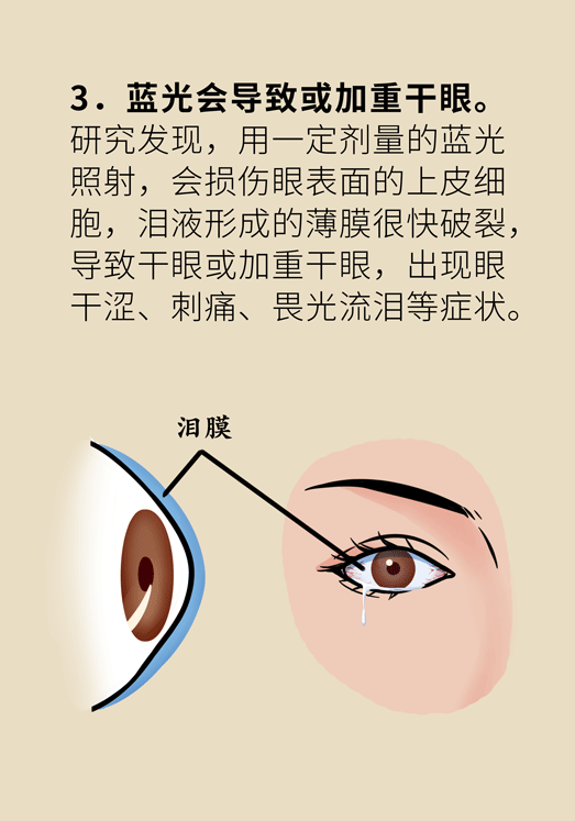 防蓝光眼睛保护是怎么回事？