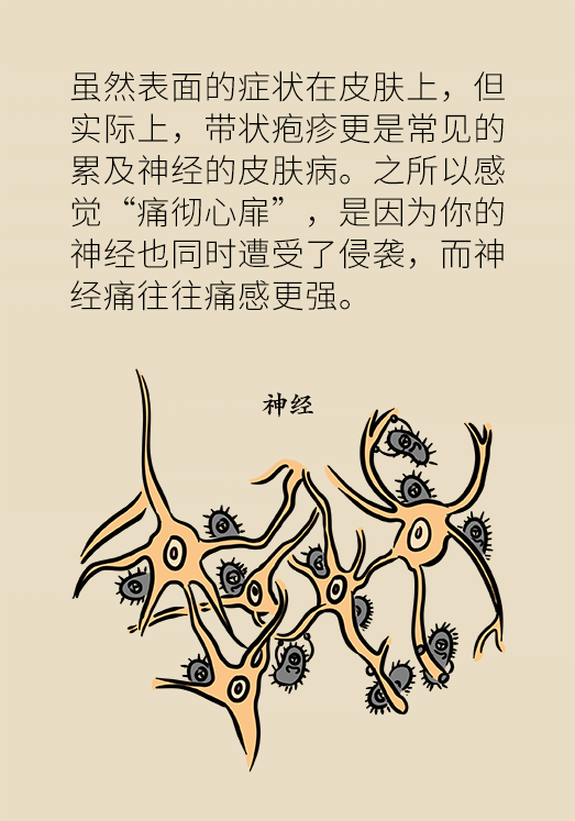 带状孢疹病毒