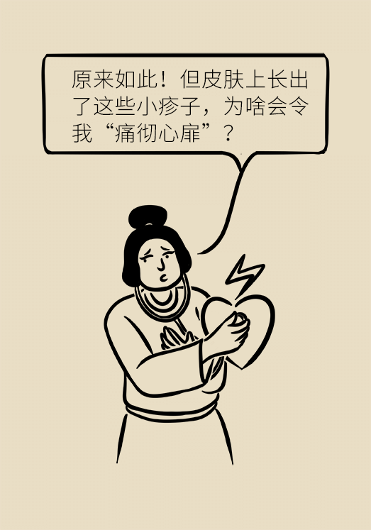 带状孢疹病毒