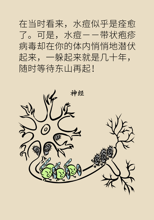 带状孢疹病毒