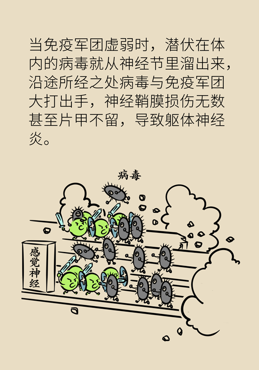 带状孢疹病毒