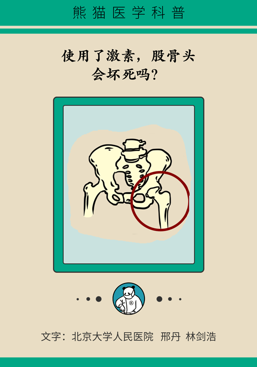 激素会带来股骨头坏死的后遗症吗？
