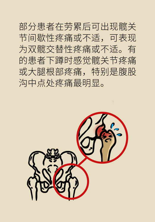 激素会带来股骨头坏死的后遗症吗？