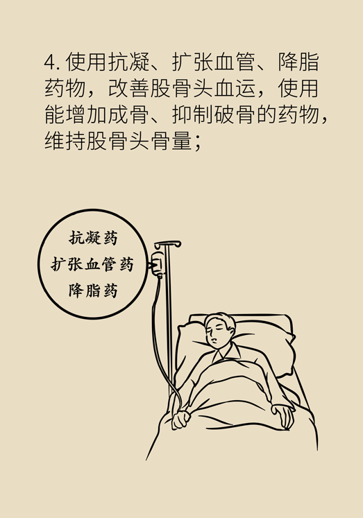 激素会带来股骨头坏死的后遗症吗？