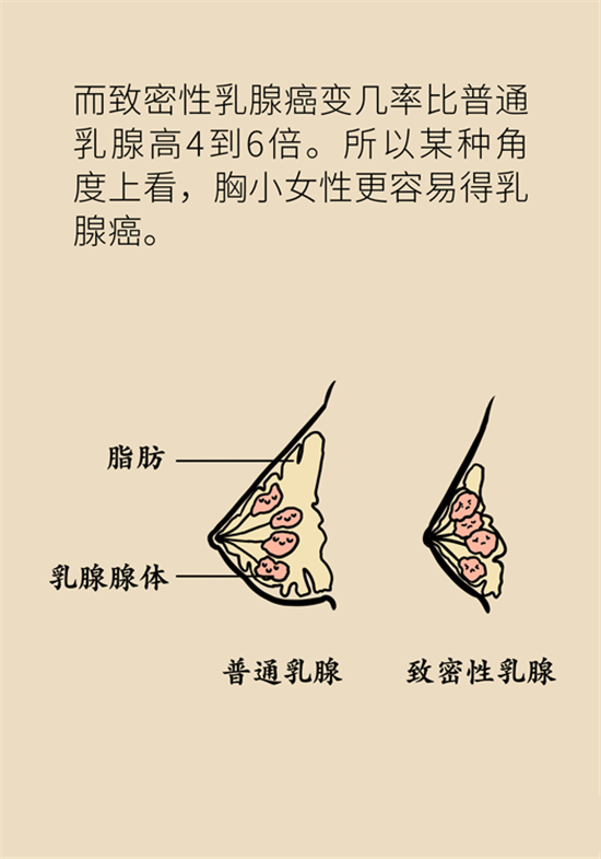 胸小是不是就不会患乳腺癌？