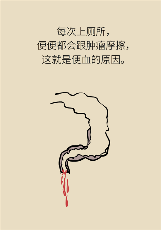 肠镜检查科普动漫制作