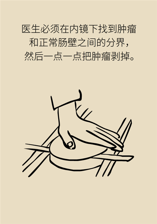 肠镜检查科普动漫制作
