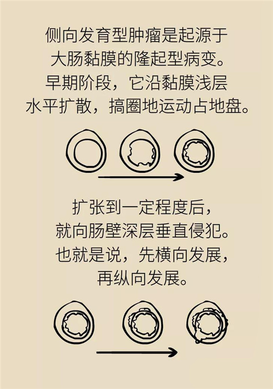 肠镜检查科普动漫制作