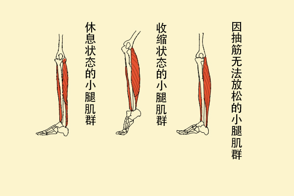 为什么缺钙会导致抽筋? 为什么缺钙会导致抽筋?