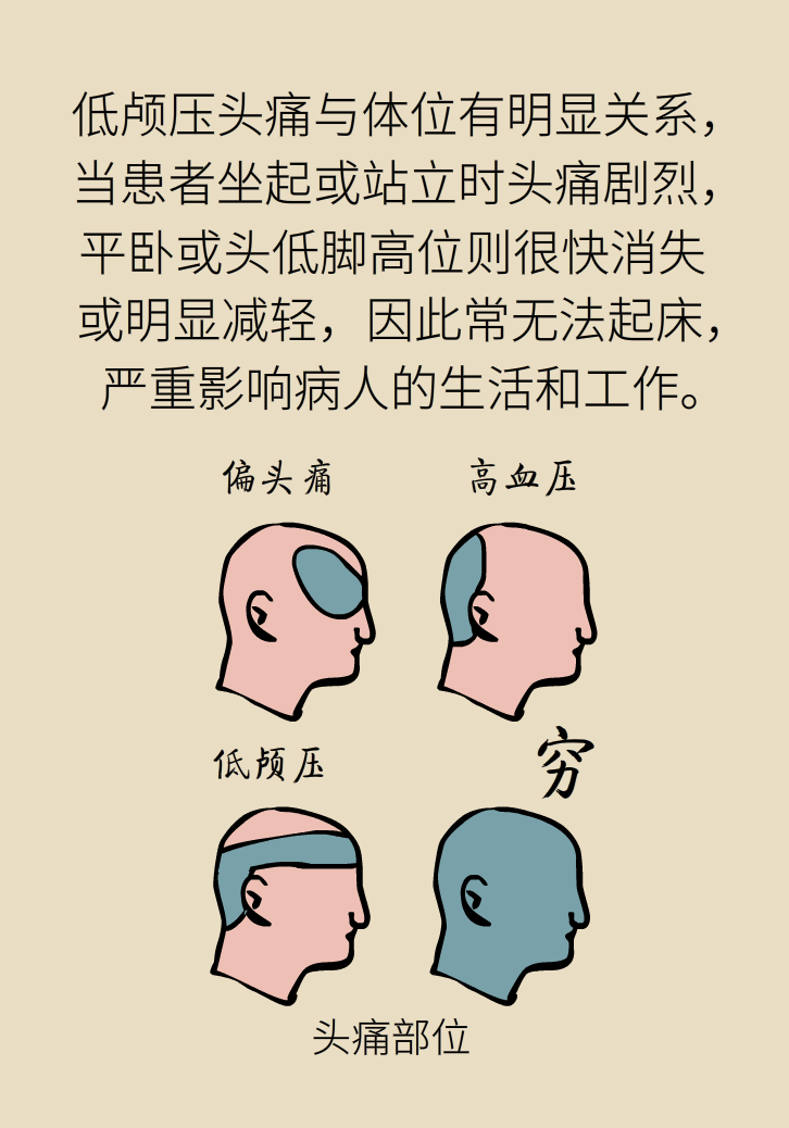 练瑜伽把脑脊液拉漏了！常见的“瑜伽病”你知道多少