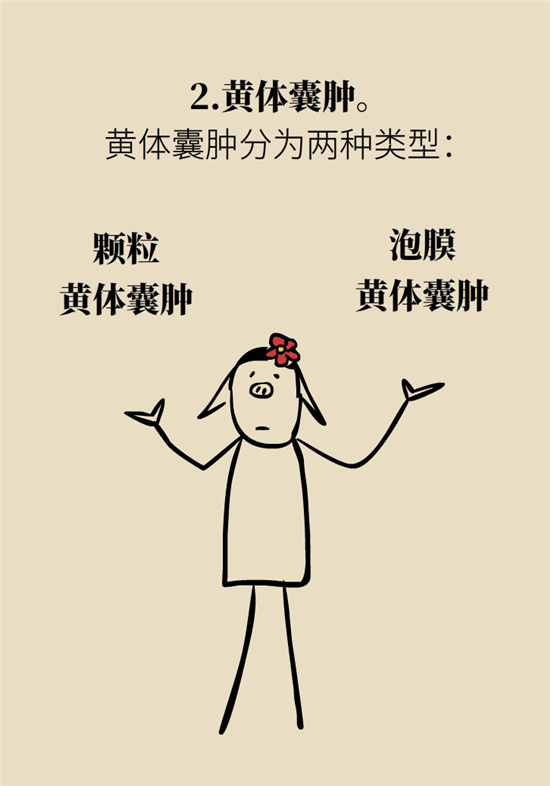 卵巢囊肿科普动漫：卵巢囊肿是肿瘤吗？要学会这样区分