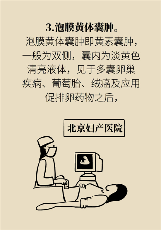 卵巢囊肿科普动漫：卵巢囊肿是肿瘤吗？要学会这样区分