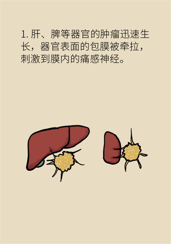 癌症到底有多痛？需要注意这7个重点问题