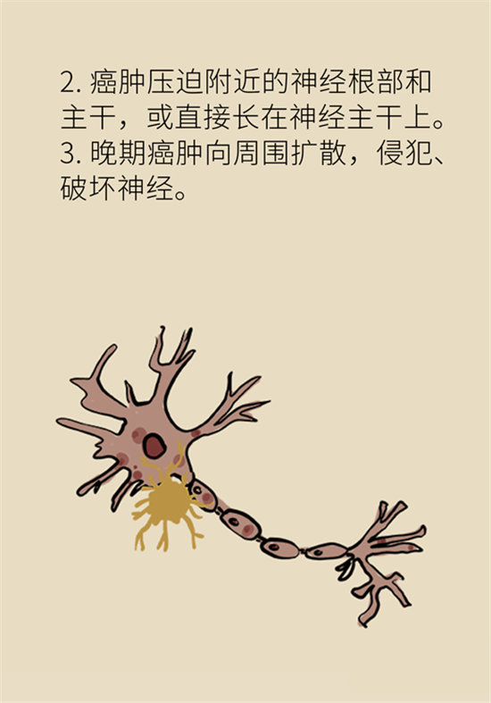 癌症到底有多痛？需要注意这7个重点问题