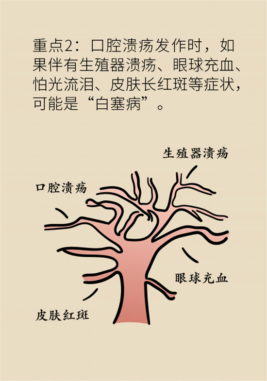 口腔溃疡还想约火锅？这四种情况一定要高度警惕