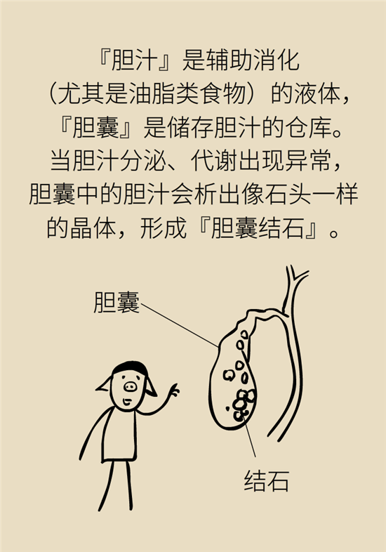 结石科普：身体里多了各种结石，应该怎么办？