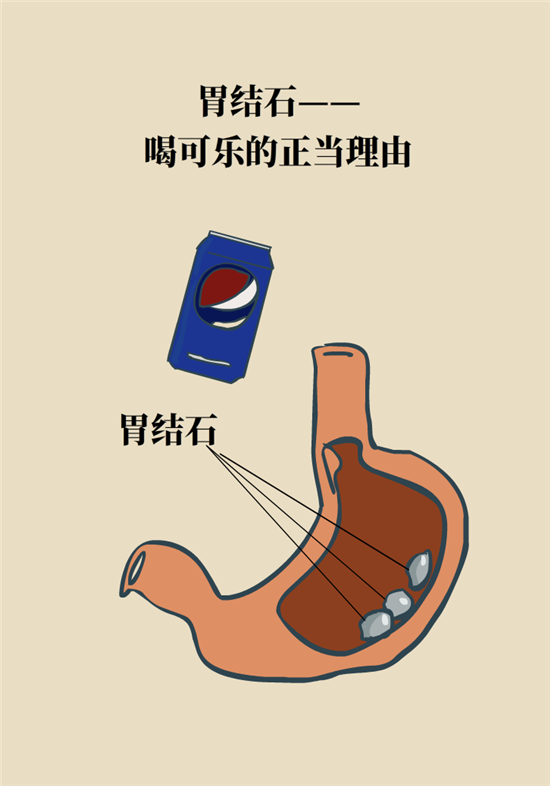 结石科普：身体里多了各种结石，应该怎么办？