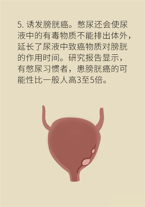 憋尿的7大危害，你真的了解吗？