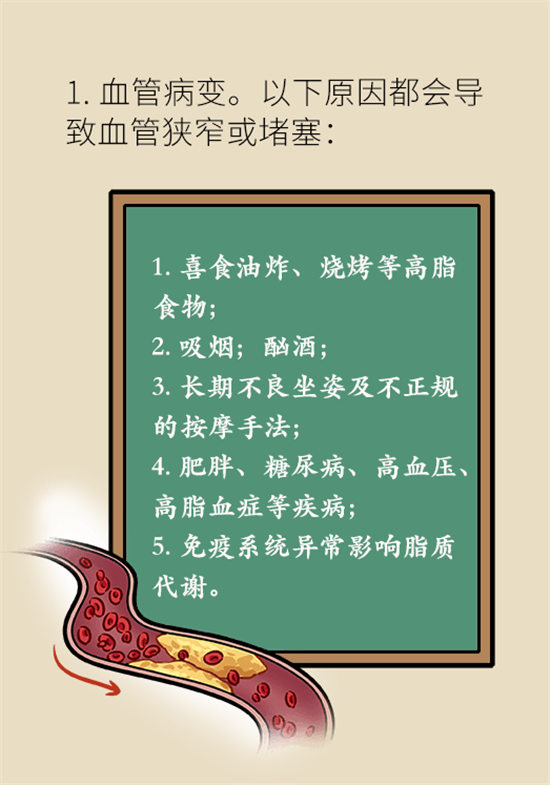 年纪轻轻别大意，小心脑卒中