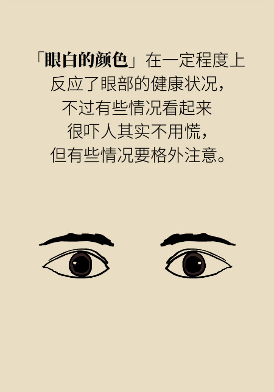 眼白有斑块、出血要紧吗?专家:名字唬人但问题不大 眼白有斑块、出血要紧吗?专家:名字唬人但问题不大
