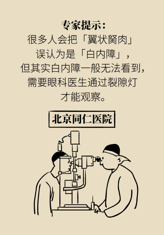 眼白有斑块、出血要紧吗?专家:名字唬人但问题不大 眼白有斑块、出血要紧吗?专家:名字唬人但问题不大