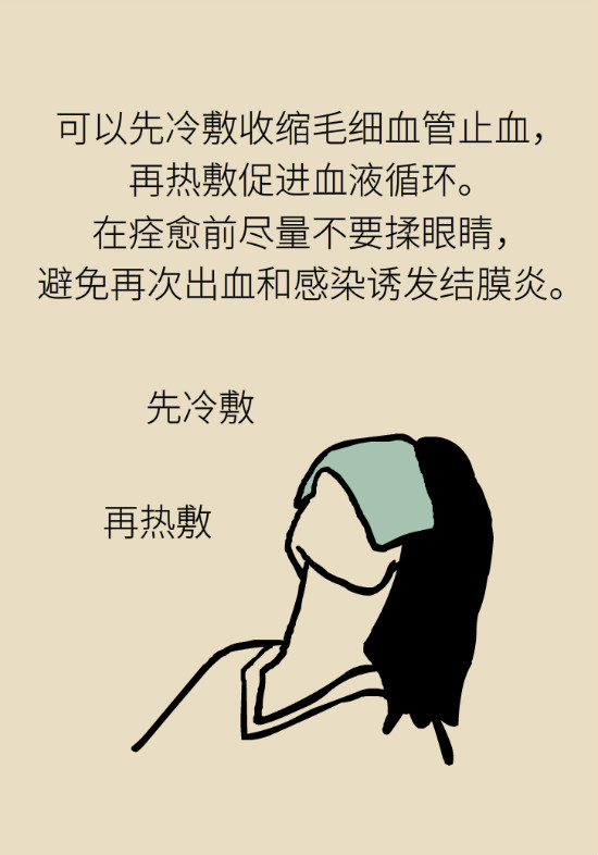 眼白有斑块、出血要紧吗?专家:名字唬人但问题不大 眼白有斑块、出血要紧吗?专家:名字唬人但问题不大
