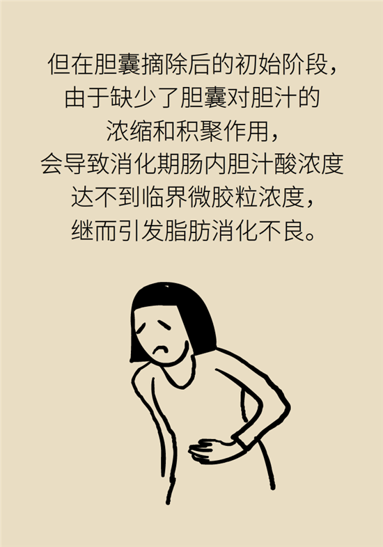 胆结石主要成分竟是胆固醇？预防它只需四个字