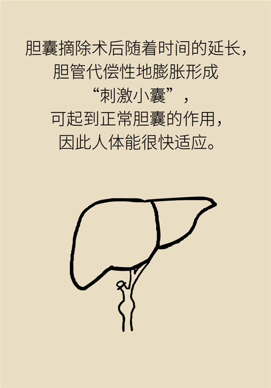 胆结石主要成分竟是胆固醇？预防它只需四个字