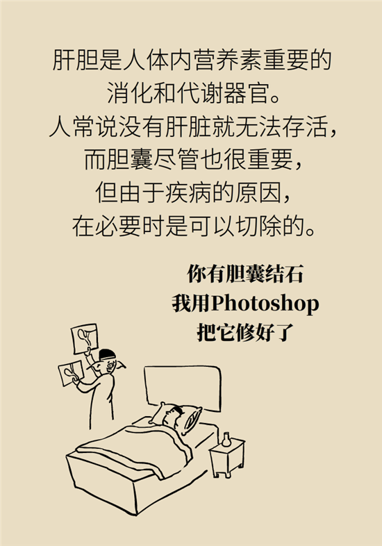 胆结石主要成分竟是胆固醇？预防它只需四个字