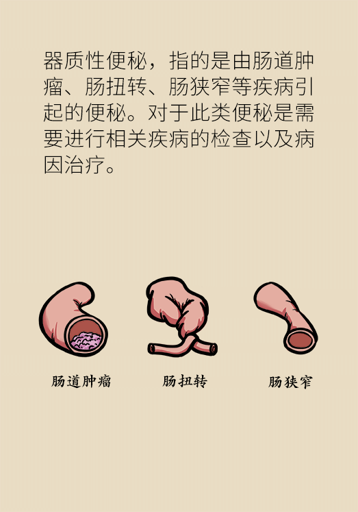 香蕉真的会缓解便秘吗？