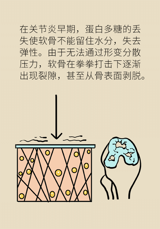 人老关节也会老吗？