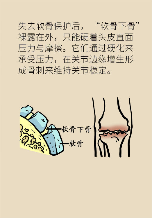 人老关节也会老吗？