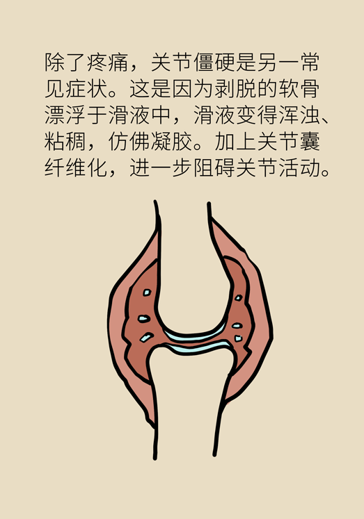人老关节也会老吗？