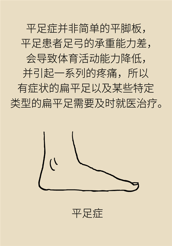 走几百米路就疼得不行了?可能患上了平足症 走几百米路就疼得不行了?可能患上了平足症