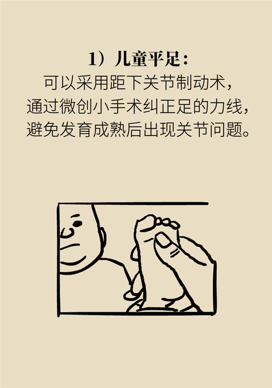 走几百米路就疼得不行了?可能患上了平足症 走几百米路就疼得不行了?可能患上了平足症
