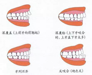 儿童换牙常见3大问题,保护牙齿需要做好这5点 儿童换牙常见3大问题,保护牙齿需要做好这5点
