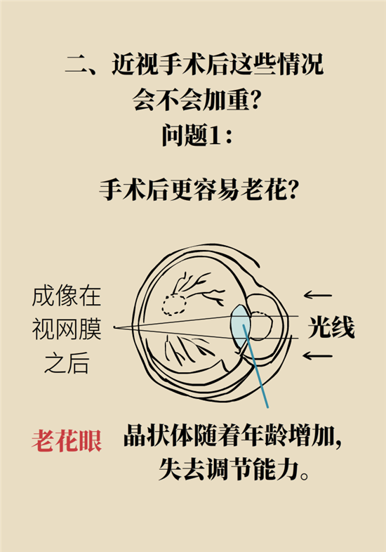 近视科普动漫制作 近视