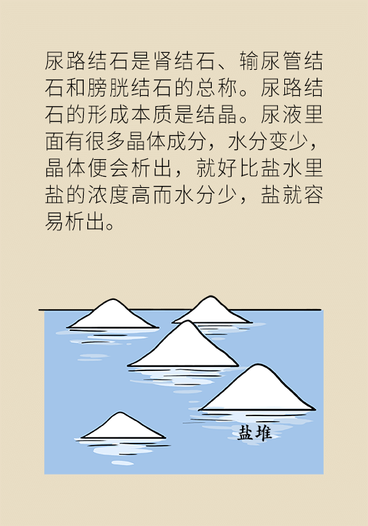 结石科普动漫制作 结石科普动漫制作