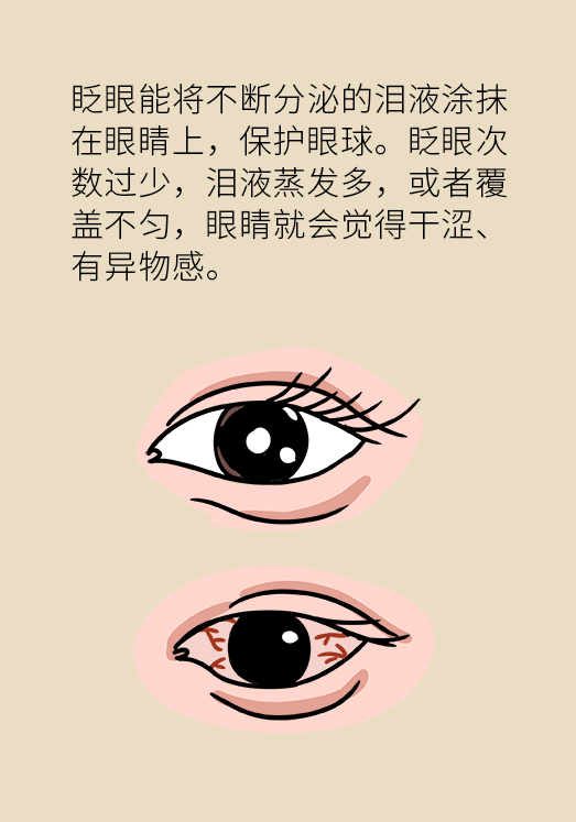熬夜追剧 熬夜追剧后眼睛干涩疼痛?