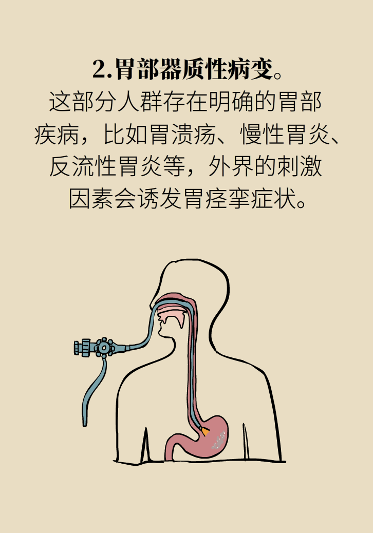 胃痉挛科普动漫制作