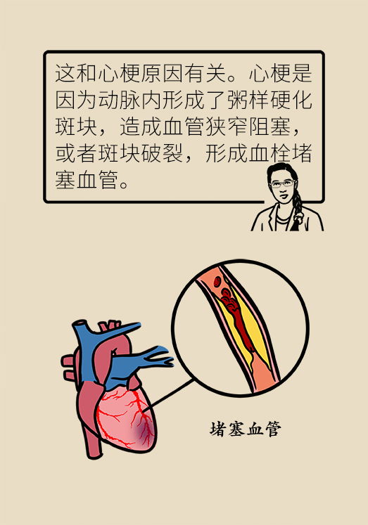 心梗科普动漫制作