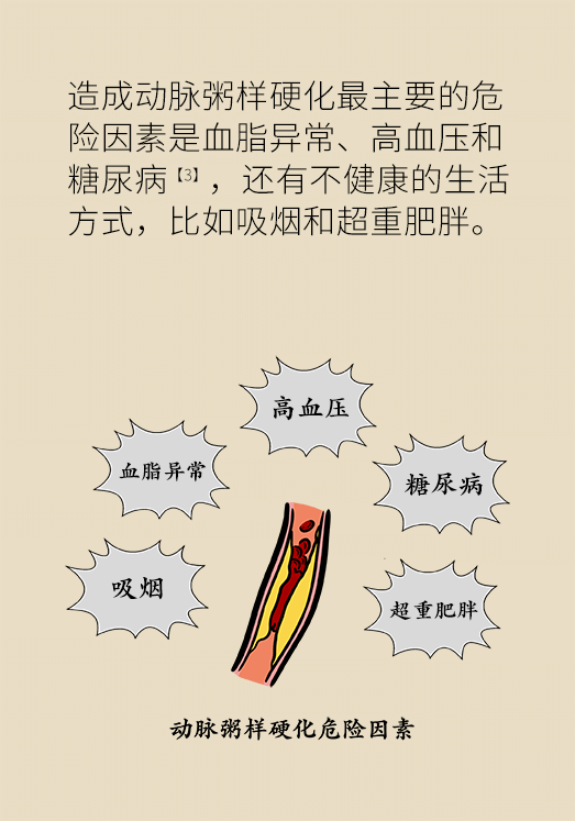 心梗科普动漫制作