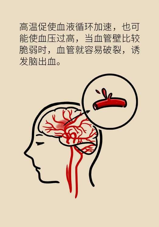 高血压科普动漫制作