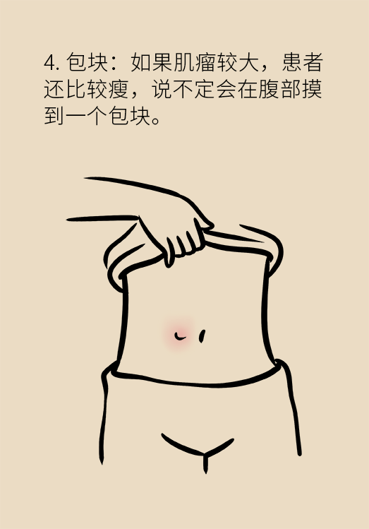 子宫肌瘤科普动漫制作