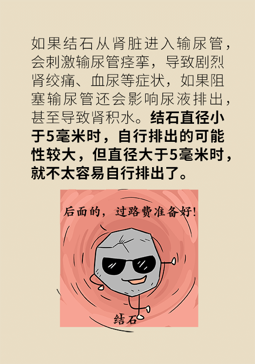 尿结石科普动漫