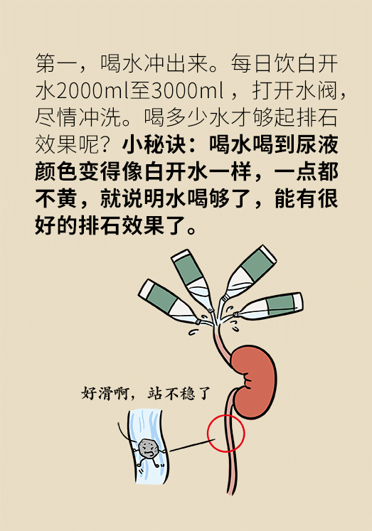 尿结石科普动漫