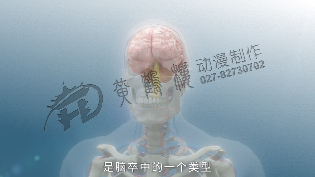 《缺血性脑卒中》三维医疗科普动画宣传片
