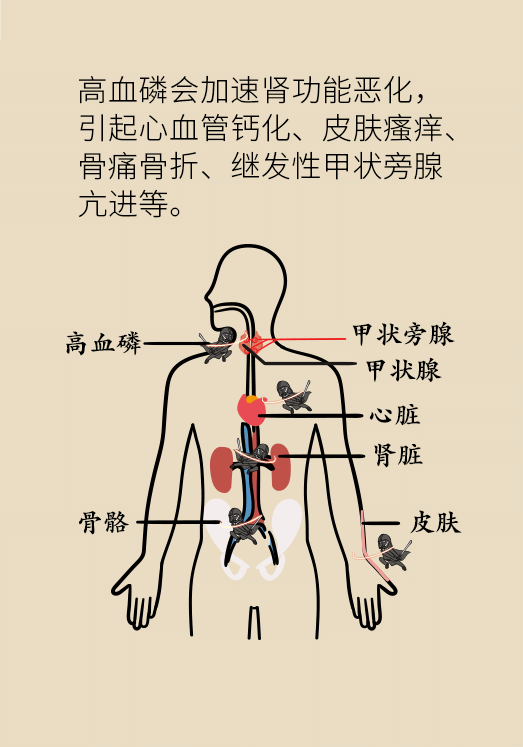 肾科普动漫制作