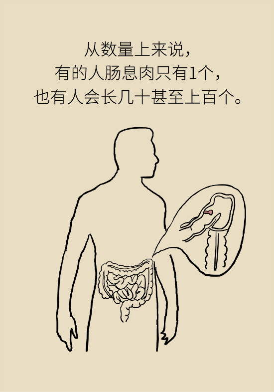 大肠癌科普动漫制作