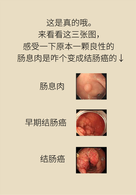 大肠癌科普动漫制作